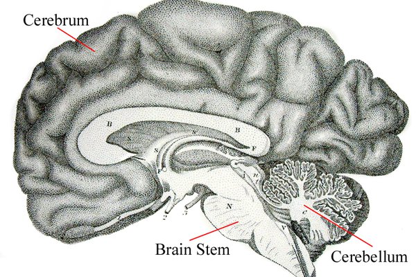 Brain diagram