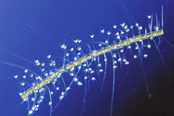 Vorticellid ciliate